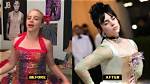 Did Billie Eilish Have Breast Reduction? a Comprehensive Analysis
