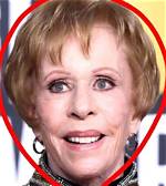 Did Carol Burnett Have a Stroke? Understanding Her Health Journey and Legacy