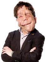 Exploring Adam Pearson's Relationships: a Journey Through Love and Connection