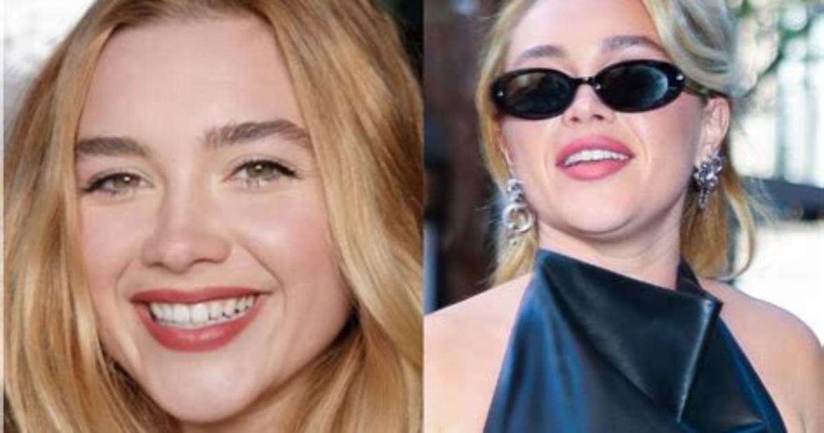 Florence Pugh Lip Filler: the Transformation of a Rising Star