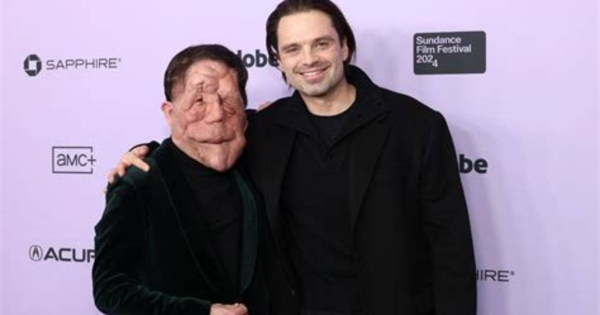 Is Adam Pearson Married? Exploring the Life of the Inspirational Advocate