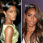 Jada Pinkett Smith's Transformation: Before the Knife