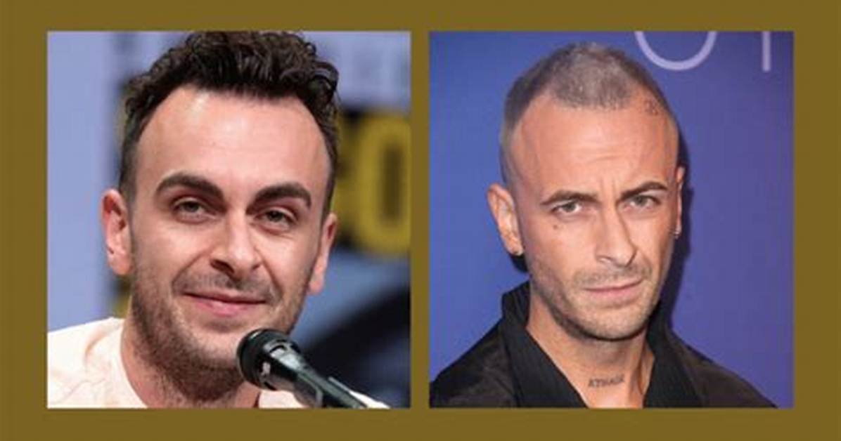 Joe Gilgun Twin: Exploring the Life and Career of the Talented Actor
