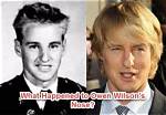 Owen Wilson's Nose: the Story Behind His Distinctive Feature