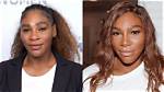 Serena Williams Surgery: a Comprehensive Insight into Her Journey and Recovery