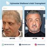 Sylvester Stallone Hair: a Comprehensive Look at His Iconic Hairstyles Through the Year's