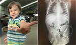 What Happens If You Swallow a Bullet?